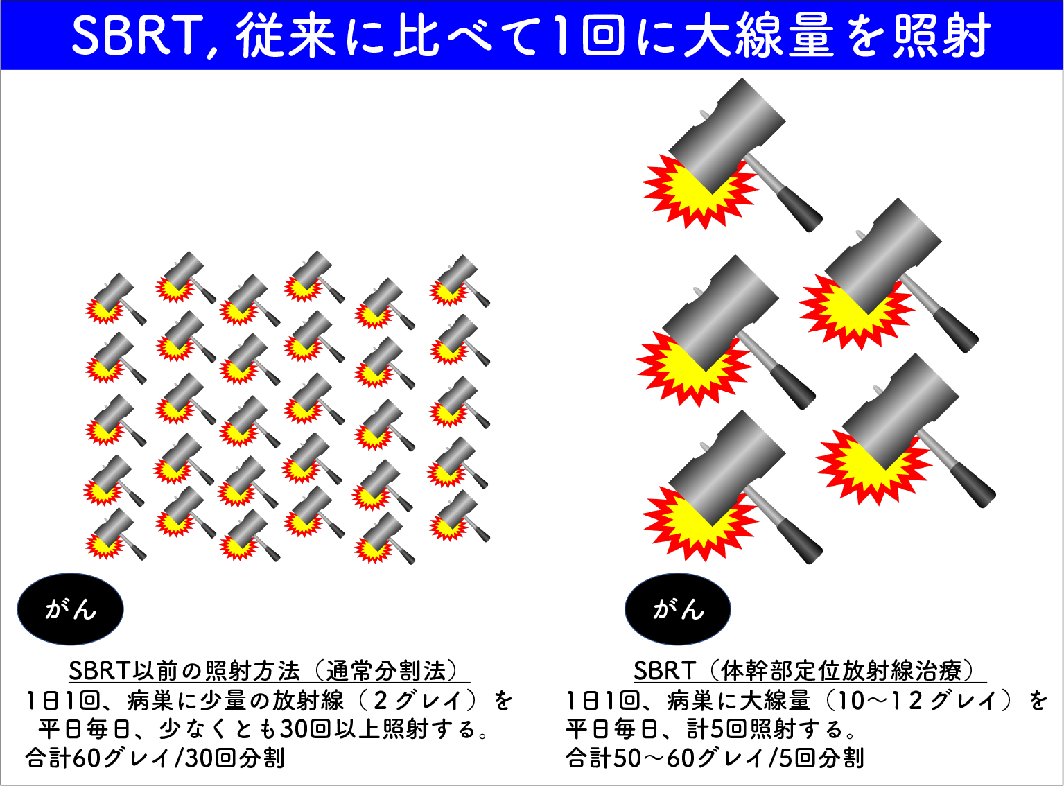 SBRT(体幹部定位放射線治療）とそれまでの照射方法（通常分割法）の比較。1回にあてる放射線量