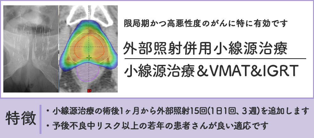 外部照射併用小線源治療